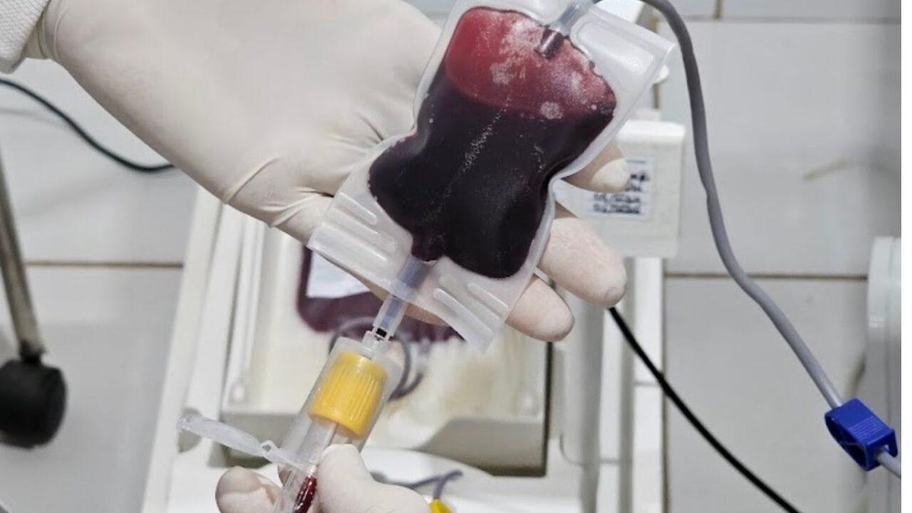 Fhemeron reforça doação de medula óssea que é vital para o tratamento de mais de 50 doenças hematológicas