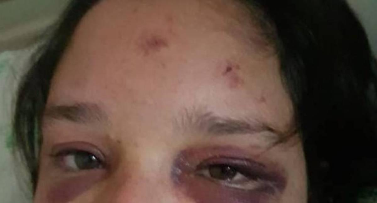 Mulher é espancada e ameaçada de morte pelo ex-marido em Vilhena